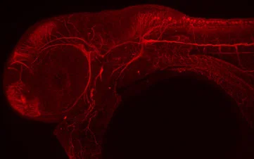 Neuropathy research image